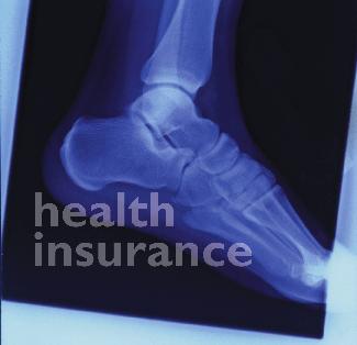 individual health insurance online